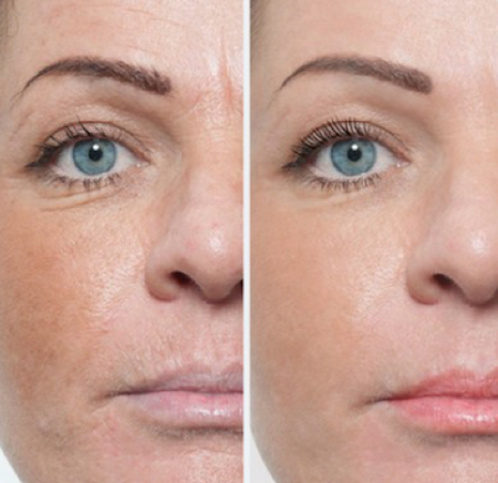 Collagen.002